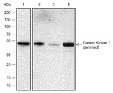 Recombinant Casein Kinase 1 gamma 2 Monoclonal Antibody-searchlist-1