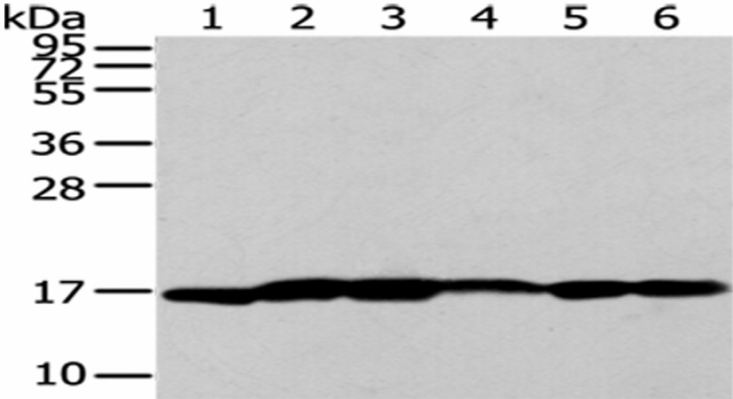 Western Blot analysis of A431 cells and Human liver cancer tissue, Lovo and PC3 cells, Human placenta tissue and 293T cells using UTS2B Polyclonal Antibody at dilution of 1/200