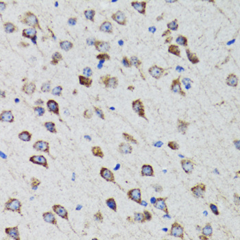 Immunohistochemistry of paraffin-embedded Rat brain using HEXA Polyclonal Antibody at dilution of 1:100 (40x lens).
