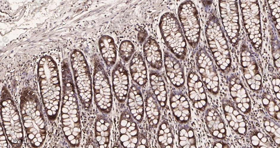 Recombinant TATA Box Binding Protein Monoclonal Antibody - 2