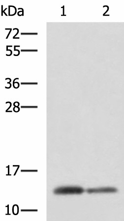 Western blot analysis of Human breast tissue and Human thyroid tissue lysates  using CRABP1 Polyclonal Antibody at dilution of 1:2000