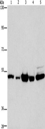 Western Blot analysis of Human bladder carcinoma and brain malignant glioma tissue, A172 cell, Human fetal brain tissue and hela cell using PDE4D Polyclonal Antibody at dilution of 1:450