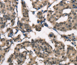 NSMCE3 Polyclonal Antibody - 2