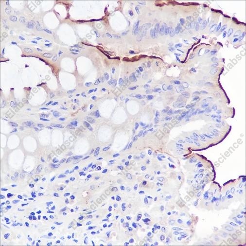 Recombinant CEACAM1 Monoclonal Antibody - 3
