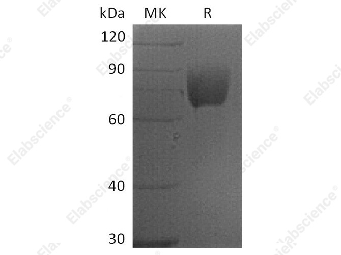 Recombinant Human CD80/B7-1 Protein (mFc Tag) - 1