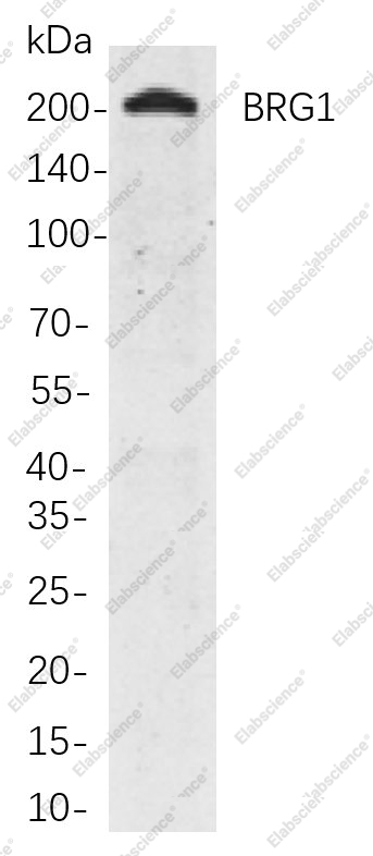 Recombinant BRG1 Monoclonal Antibody - 1