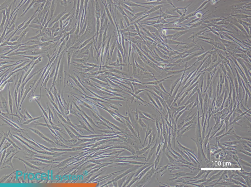 Human Skeletal Muscle Fibroblast Complete Medium - 3