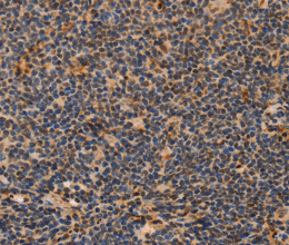 MPG Polyclonal Antibody - 2