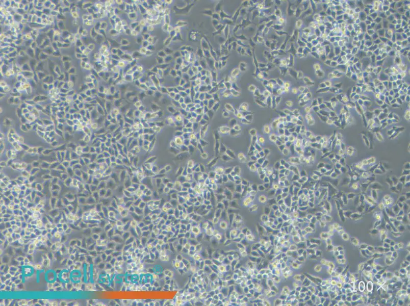 TOV-21G Cell Complete Medium - 2