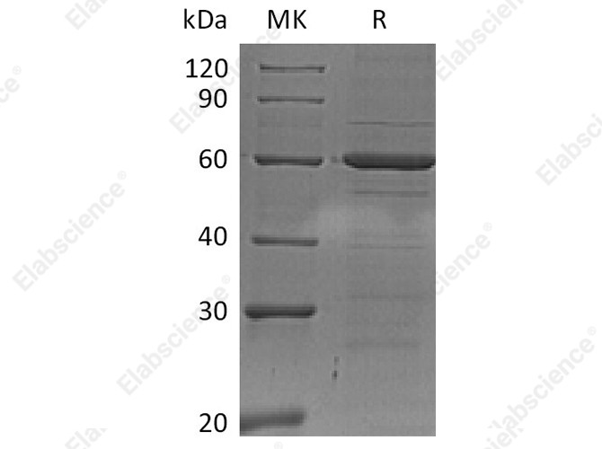 Recombinant Human IRF5 Protein (His Tag) - 1