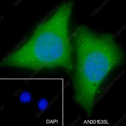 Recombinant GNB2 Monoclonal Antibody - 2