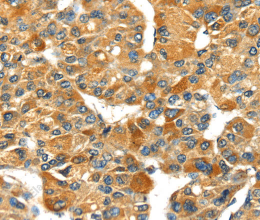 SPARC Polyclonal Antibody - 2