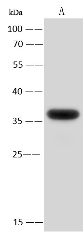 EMAPII/AIMP1 Monoclonal Antibody-searchlist-1