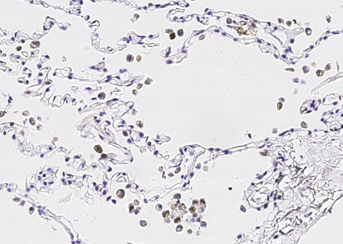 Recombinant IL36G/IL1F9 Monoclonal Antibody-searchlist-1