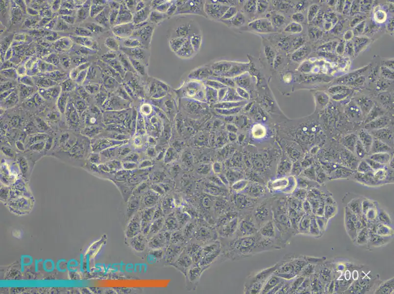 ACHN Cell Complete Medium - small - 6