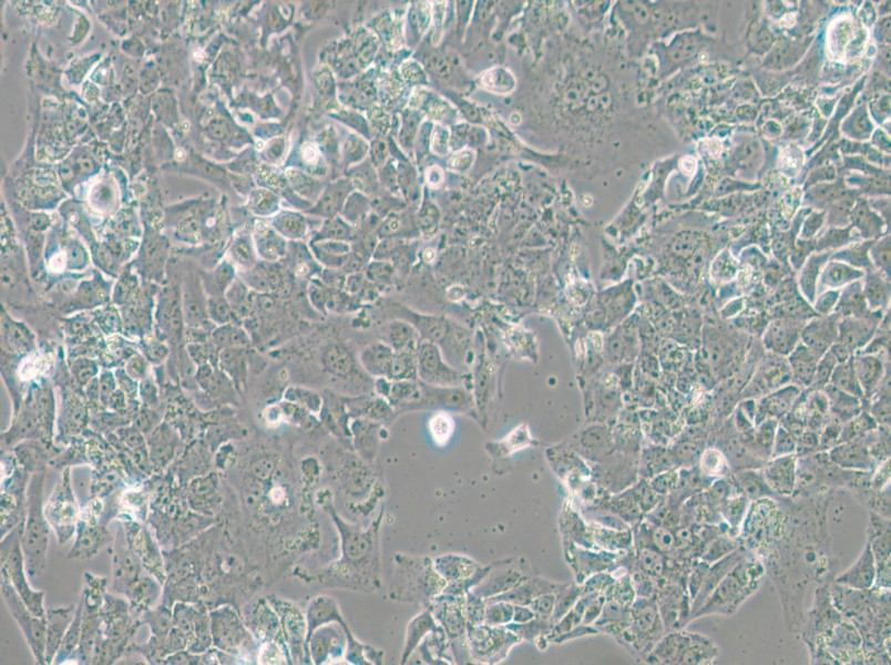 OV-90 Cell Complete Medium - 4