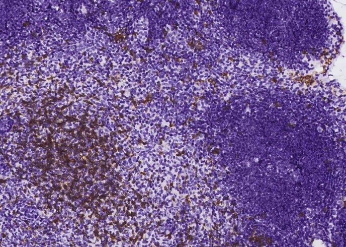 Recombinant CD8 alpha/CD8A Monoclonal Antibody - small - 2