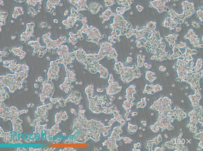 ZR-75-1 Cell Complete MediumZR-75-1 Cell Complete Medium - 2