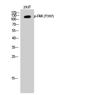 Western Blot analysis of 293T cells with Phospho-FAK (Tyr397) Polyclonal Antibody at dilution of 1:1000