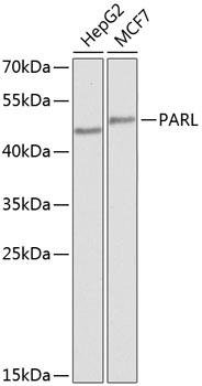 Western blot analysis of extracts of various cell lines using PARL Polyclonal Antibody at 1:1000 dilution.
