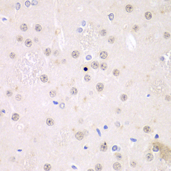 Immunohistochemistry of paraffin-embedded rat brain using FMRP Polyclonal Antibody at dilution of 1:100 (40x lens).Perform microwave antigen retrieval with 10 mM PBS buffer pH 7.2 before commencing with IHC staining protocol.