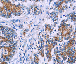 AGFG1 Polyclonal Antibody - 3