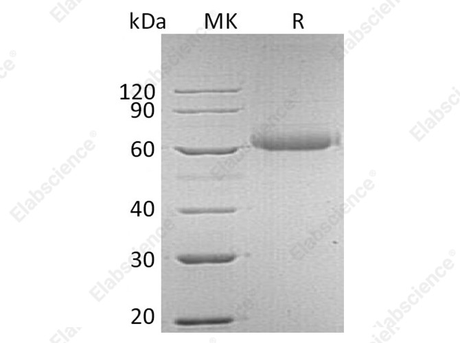 Recombinant Human FGFR5/FGFRL1 Protein (His Tag) - 1