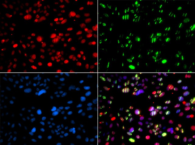 Immunofluorescence analysis of GFP-RNF168 transgenic U2OS cells using PNKP Polyclonal Antibody