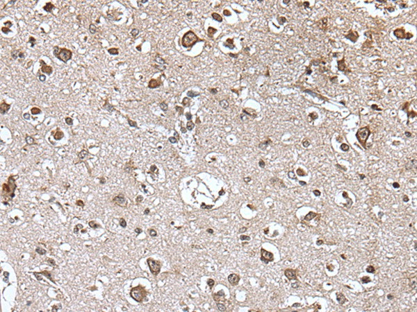 Immunohistochemistry of paraffin-embedded Human brain tissue  using TRIM27 Polyclonal Antibody at dilution of 1:45(?200)