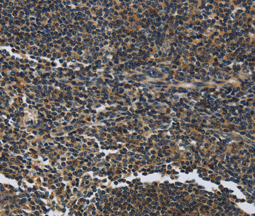 Immunohistochemistry of paraffin-embedded Human tonsil tissue using LGALS7 Polyclonal Antibody at dilution 1:50