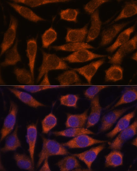 Immunofluorescence analysis of L929 cells using ME3 Polyclonal Antibody at dilution of  1:100. Blue: DAPI for nuclear staining.