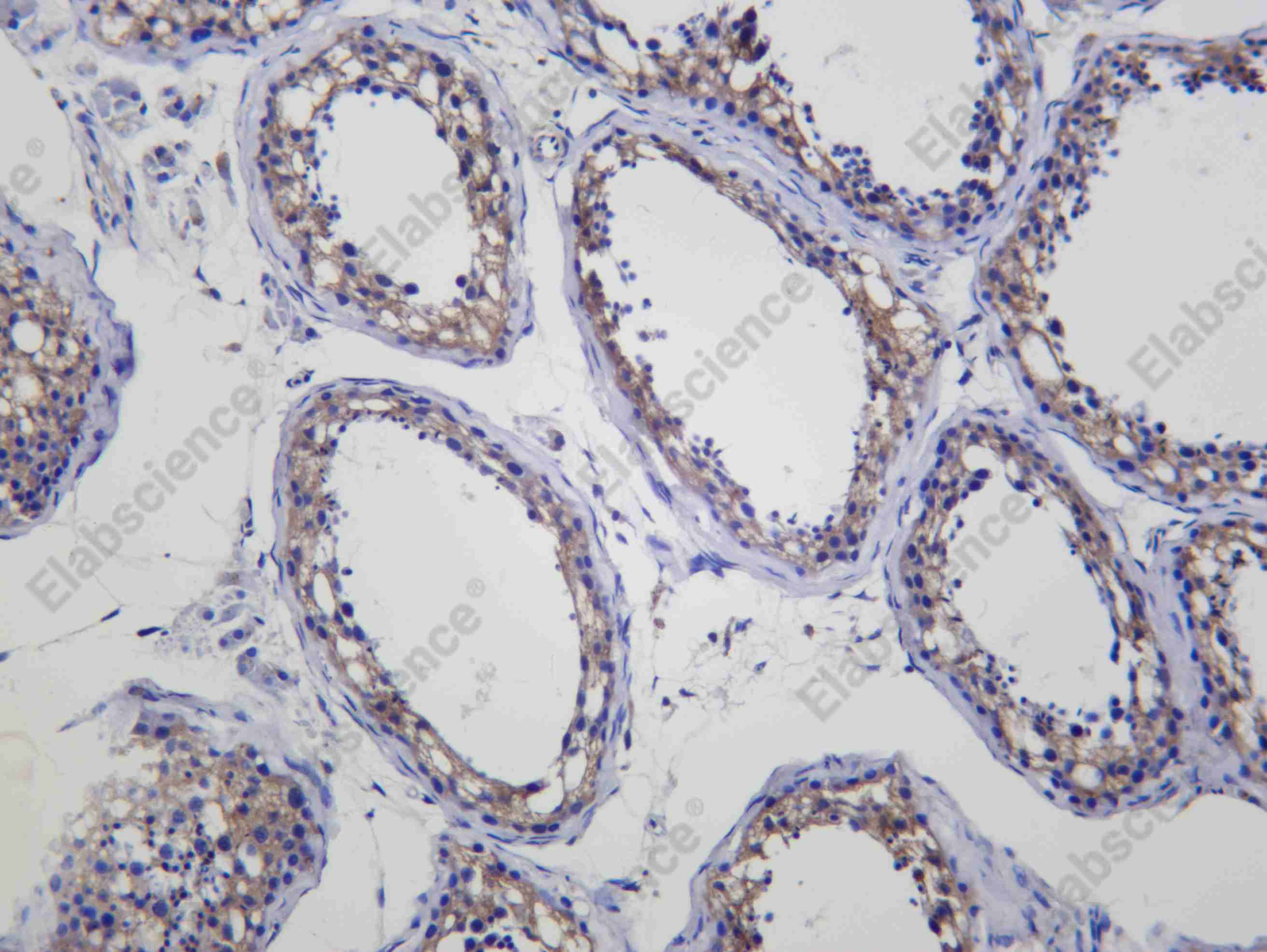 Recombinant Presenilin 2 Monoclonal Antibody - 1