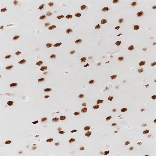 Recombinant PTBP2 Monoclonal Antibody - small - 4