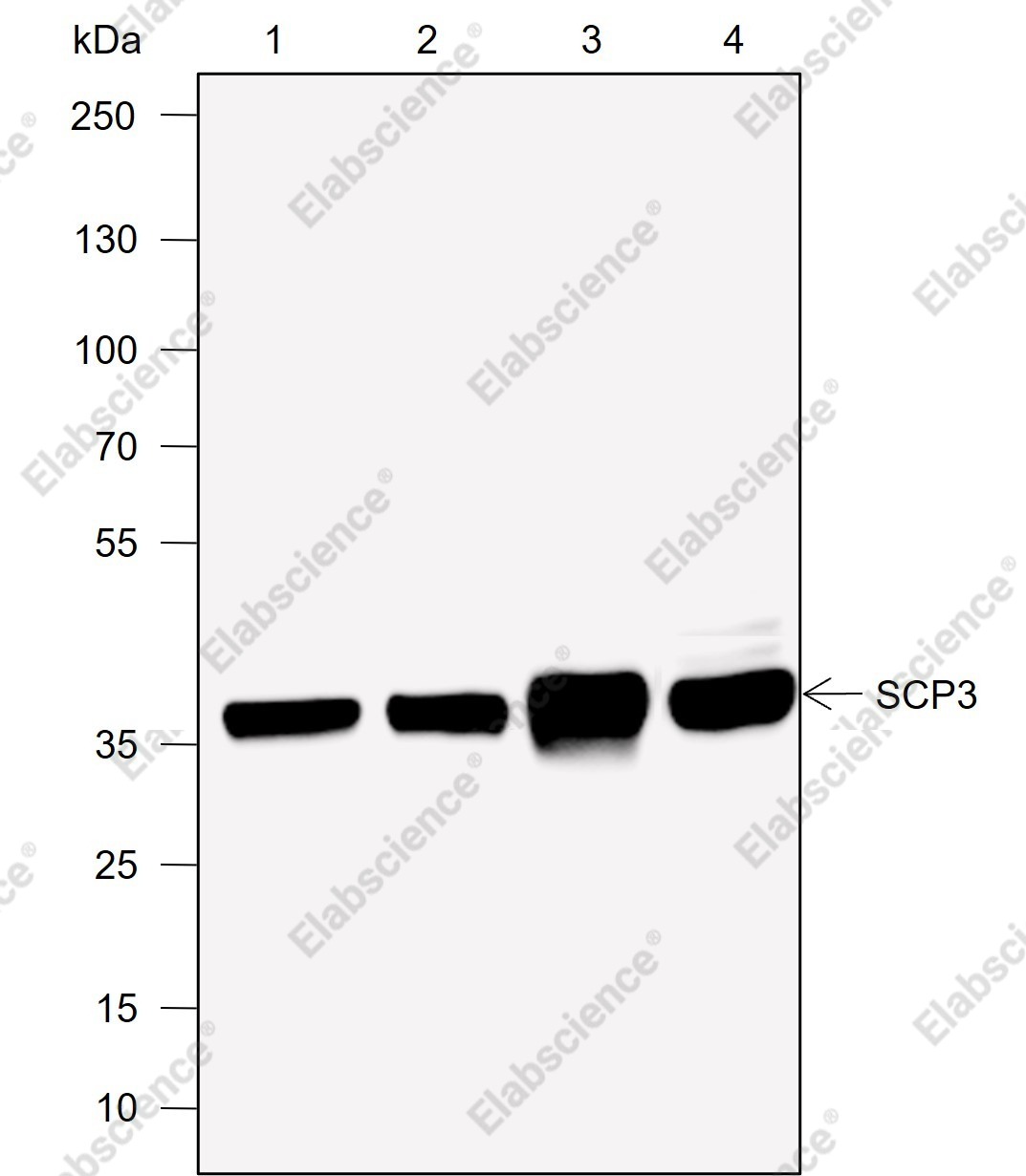 Recombinant SCP3 Monoclonal Antibody - 1