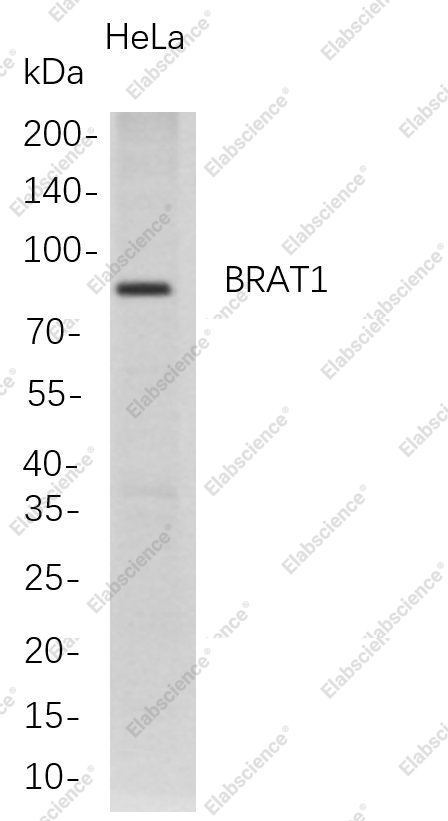 Recombinant BRAT1 Monoclonal Antibody - 1
