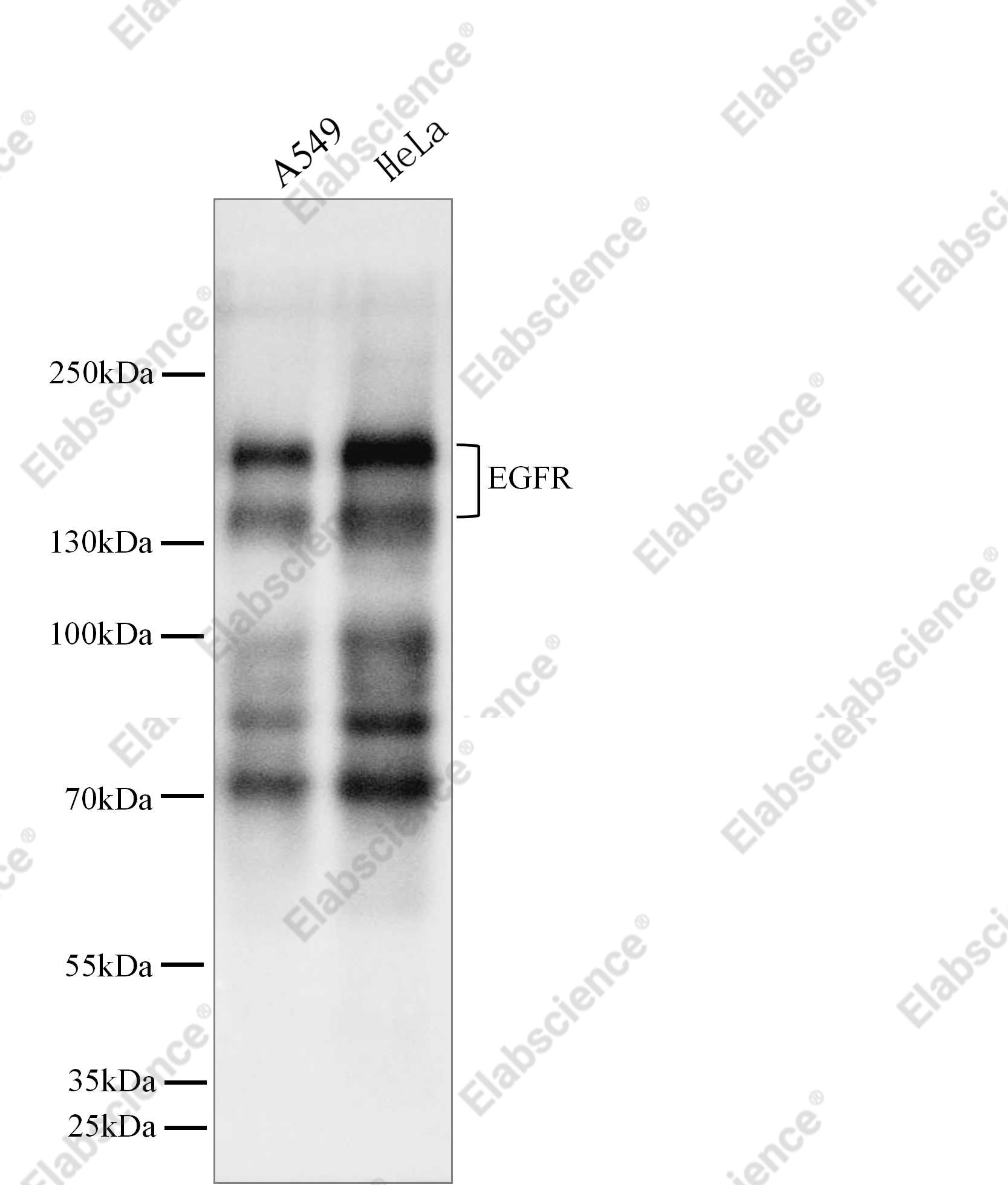 Recombinant EGFR/HER1/ErbB1 Monoclonal Antibody - 4