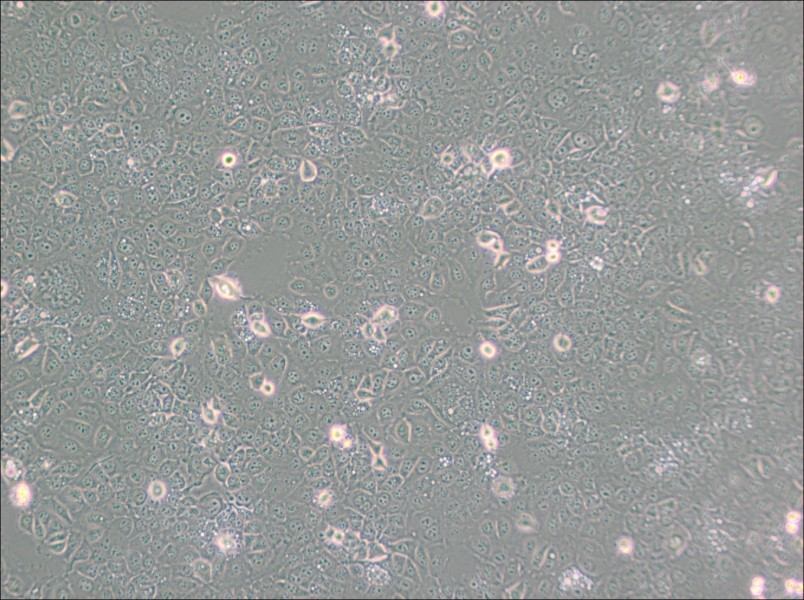 KYSE-30 Cell Complete Medium - 3