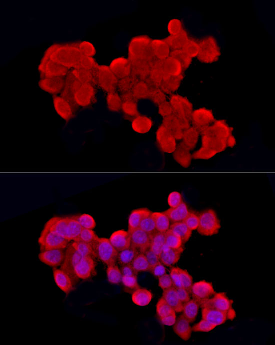 Immunofluorescence analysis of HepG2 cells using Cleaved Caspase-9 P37 Polyclonal Antibody at dilution of 1:50 (40x lens). Blue:DAPI for nuclear staining.