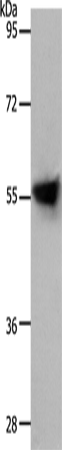 Western Blot analysis of Human liver cancer tissue using SLC1A4 Polyclonal Antibody at dilution of 1:800