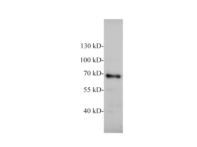 Western blot of Mouse brain with anti-NEFL polyclonal antibody at 1:1000 dilution.