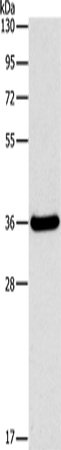 Western Blot analysis of Human fetal liver tissue using FGL1 Polyclonal Antibody at dilution of 1:1050