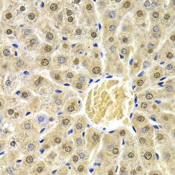 Immunohistochemistry of paraffin-embedded rat liver using RAD9A Polyclonal Antibody at dilution of 1:200 (40x lens).Perform microwave antigen retrieval with 10 mM PBS buffer pH 7.2 before commencing with IHC staining protocol.