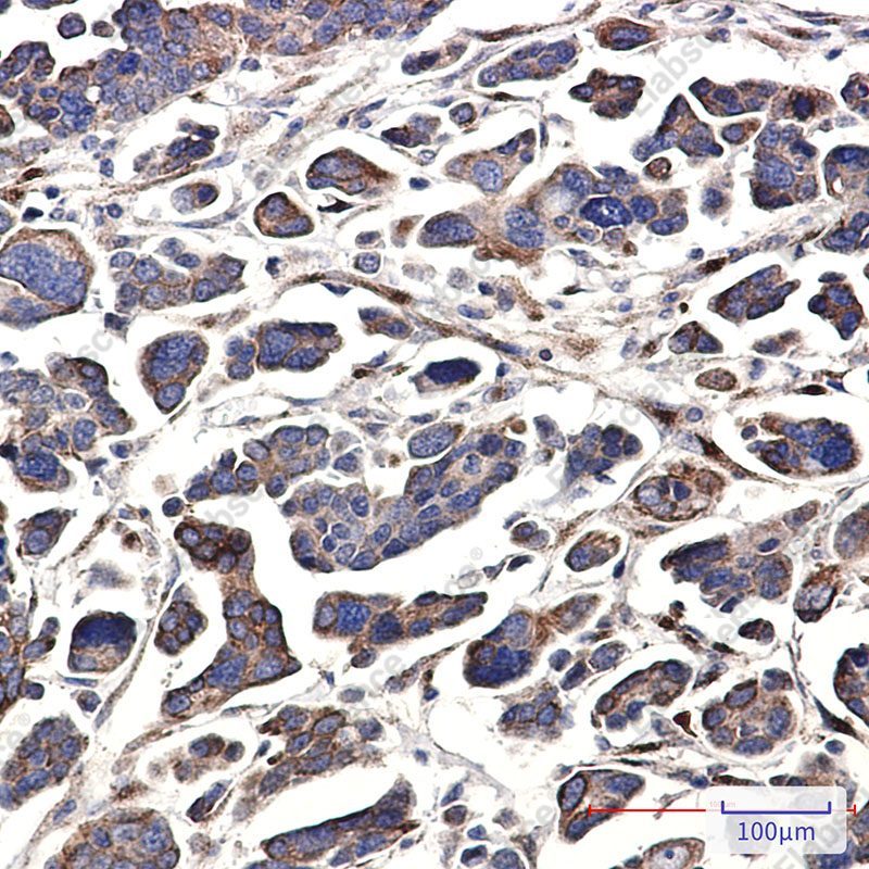 Recombinant G protein alpha 13 Monoclonal Antibody - 3