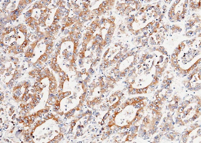 LRPAP1 Monoclonal Antibody - small - 2