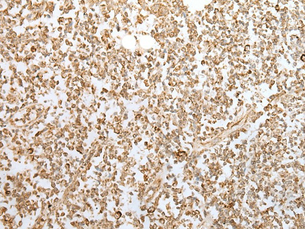 Immunohistochemistry of paraffin-embedded Human tonsil tissue  using ZKSCAN1 Polyclonal Antibody at dilution of 1:30(?200)