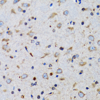 Immunohistochemistry of paraffin-embedded Mouse brain using TNFSF12 Polyclonal Antibody at dilution of 1:100 (40x lens).
