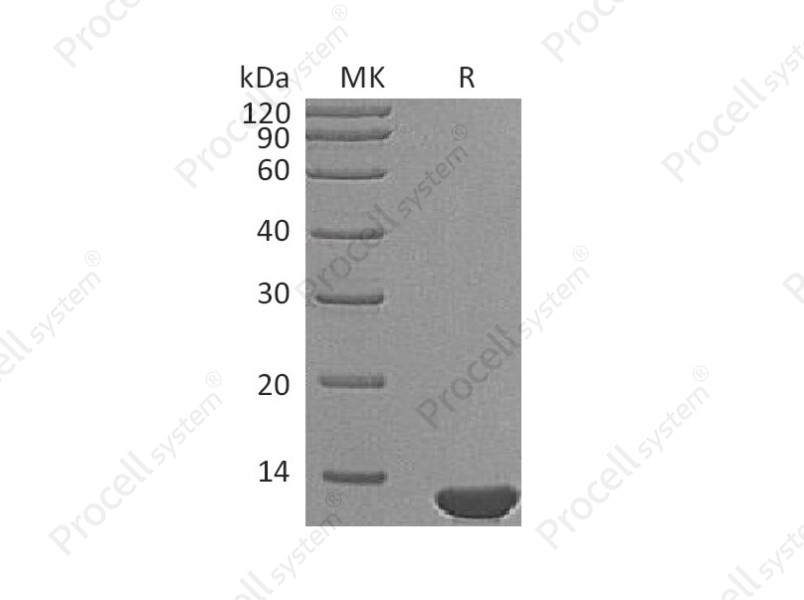 &beta;-NGF/NGF/NGFB/NGF-&beta;, Mouse, Recombinant