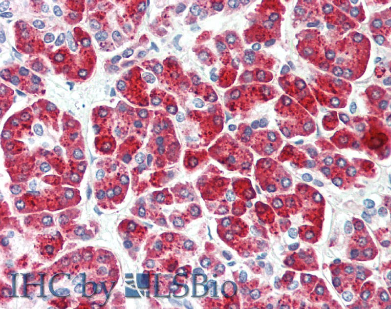 Immunohistochemistry of paraffin-embedded Human Pancreas using CPB1 Polyclonal Antibody at dilution of 1:50(Elabscience Product Detected by Lifespan).