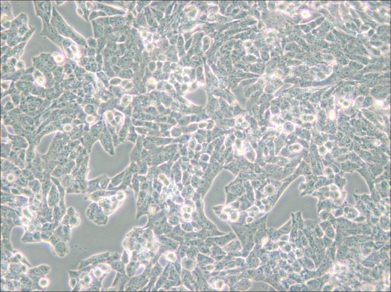 NCI-H295R Cell Complete Medium - 5