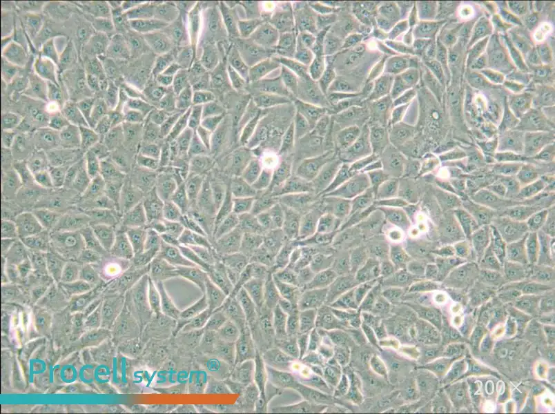 9L/lacZ Cell Complete Medium - small - 6